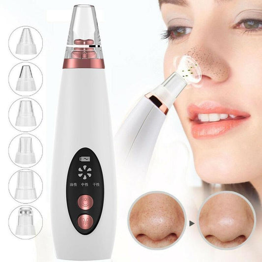 Blackhead Vacuum Cleaner – Deep Cleanse for Clear, Glowing Skin